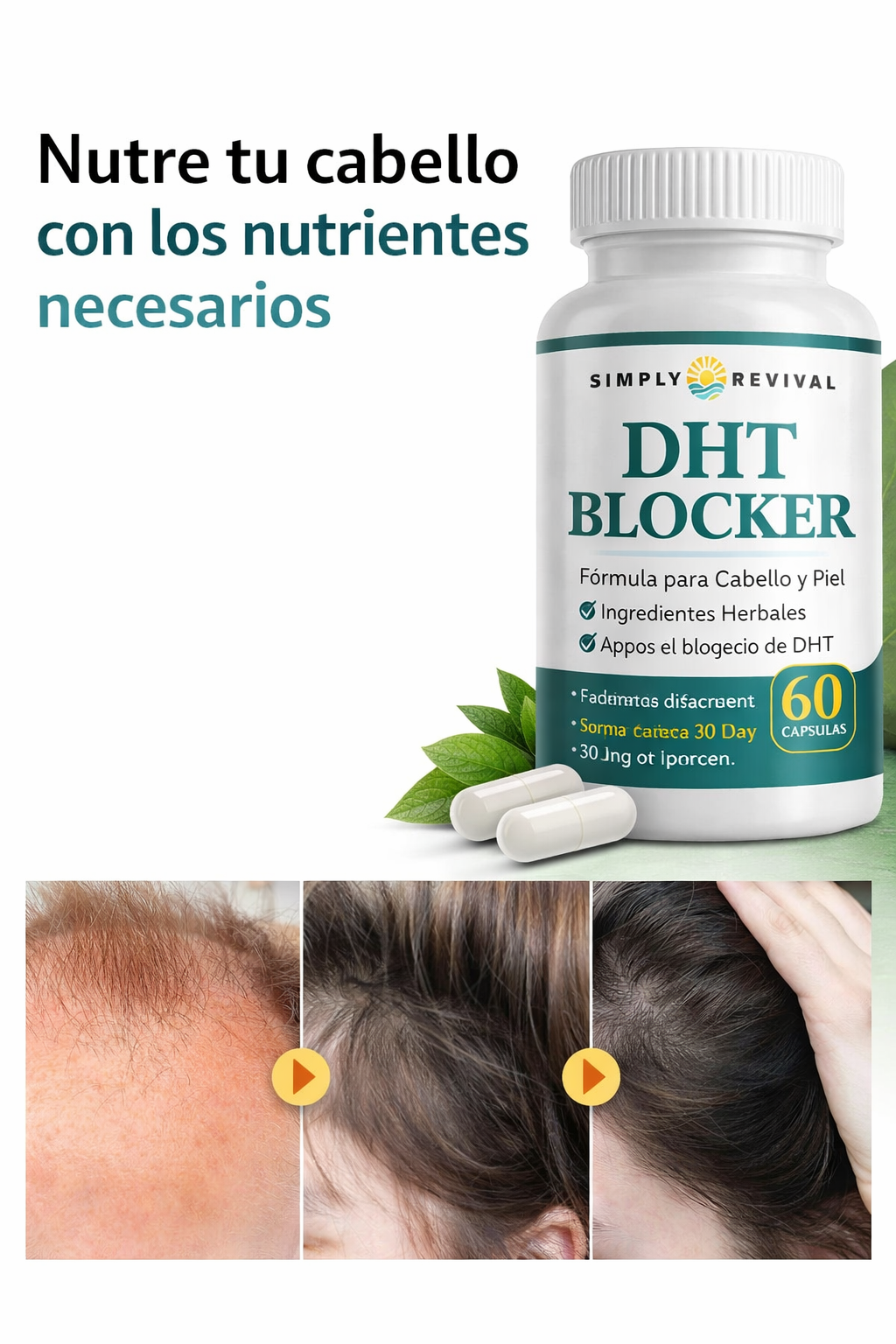 DHT ANTICALVICIE
